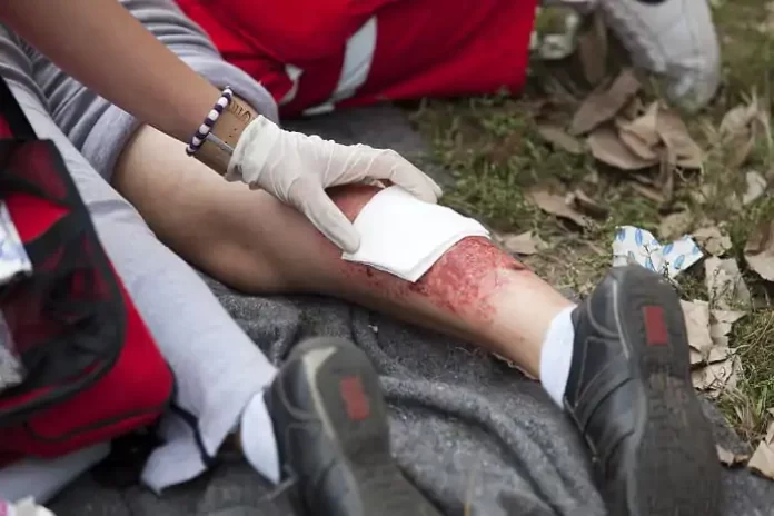 Ácido tranexâmico ajuda no desfecho de longo prazo em pacientes com trauma?